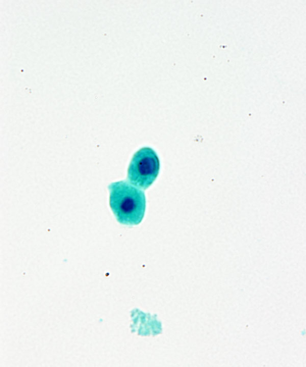 3 : Urine Normal Urine