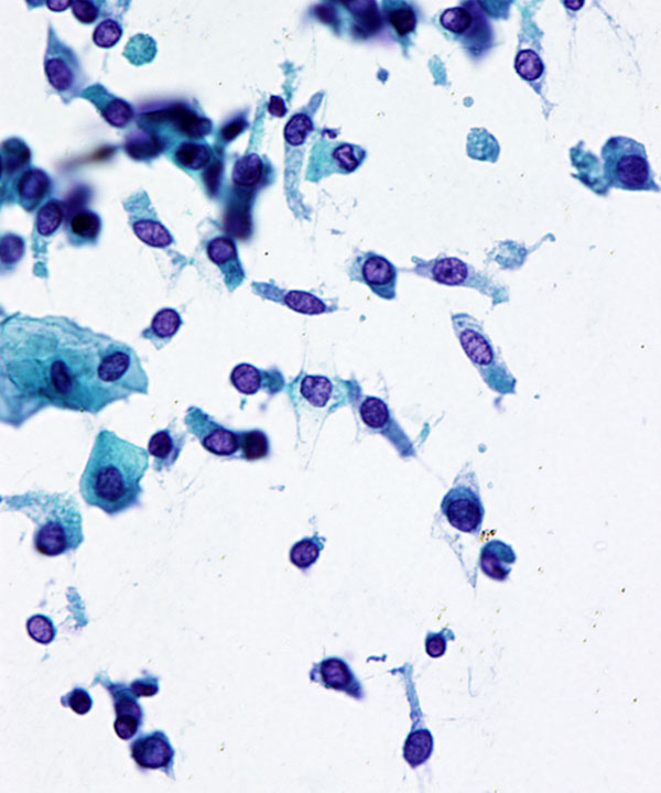 4 : Urine Normal Urine
