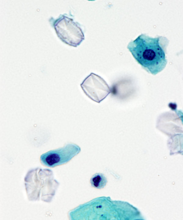 5 : Urine Normal Urine