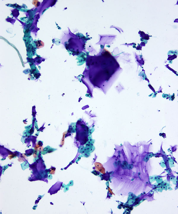 6 : Urine Normal Urine