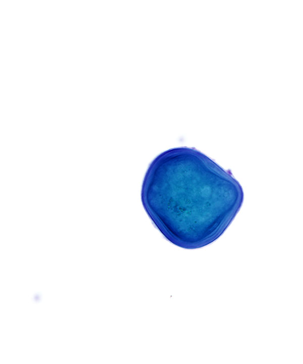 7 : Urine Normal Urine
